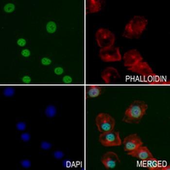 SAP155 Rabbit Monoclonal Antibody