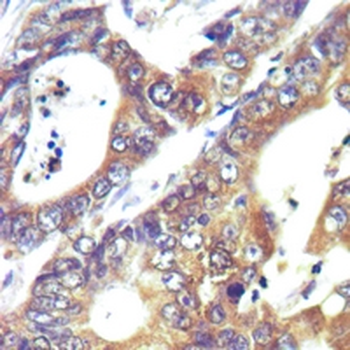 TOM20 Rabbit Monoclonal Antibody