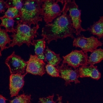 TOM20 Rabbit Monoclonal Antibody