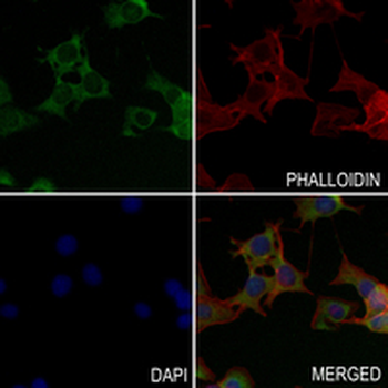 Spectrin alpha I Rabbit Monoclonal Antibody