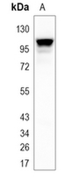 TFR2 Rabbit Monoclonal Antibody