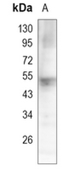 IgG Rabbit Monoclonal Antibody