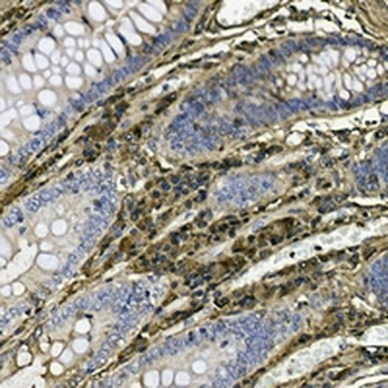 IgG Rabbit Monoclonal Antibody
