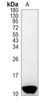 Hemoglobin gamma-1/2 Rabbit Monoclonal Antibody