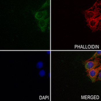 Hemoglobin gamma-1/2 Rabbit Monoclonal Antibody