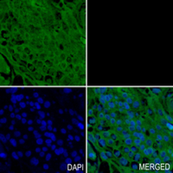 CALU Rabbit Monoclonal Antibody