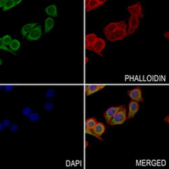 CALU Rabbit Monoclonal Antibody