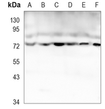 CPT2 Rabbit Monoclonal Antibody