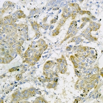 FDX1 Rabbit Monoclonal Antibody
