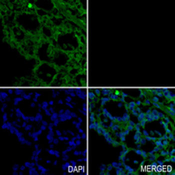 Dia 1 Rabbit Monoclonal Antibody