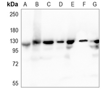 IDE Rabbit Monoclonal Antibody