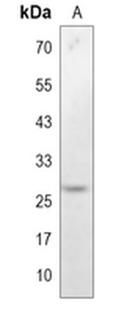 GSC1 Rabbit Monoclonal Antibody