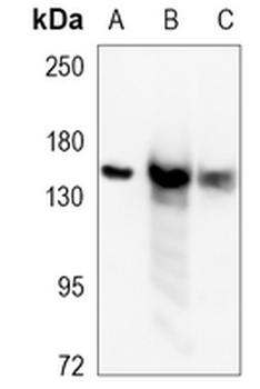CPS1 Rabbit Monoclonal Antibody