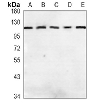 MOV10 Rabbit Monoclonal Antibody
