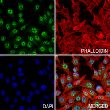 MOV10 Rabbit Monoclonal Antibody