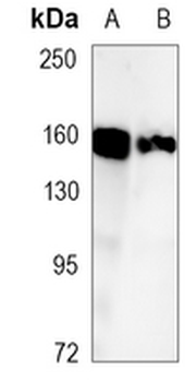 Desmoglein 2 Rabbit Monoclonal Antibody