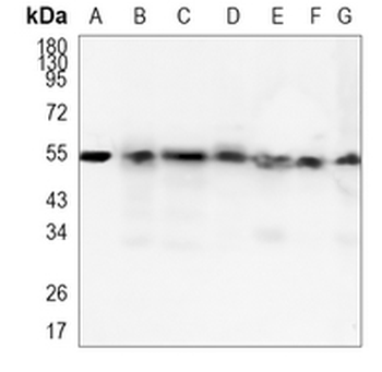 ATG5 Rabbit Monoclonal Antibody
