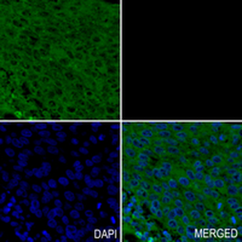 ATG5 Rabbit Monoclonal Antibody