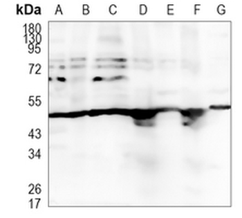 LXR alpha Rabbit Monoclonal Antibody
