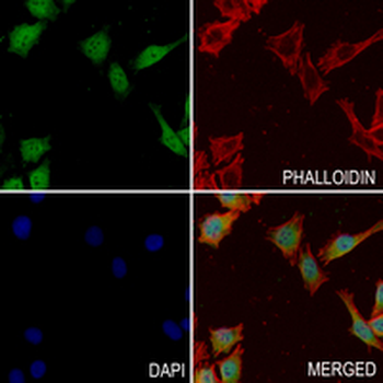 LXR alpha Rabbit Monoclonal Antibody