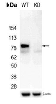 CD36L1 Rabbit Monoclonal Antibody