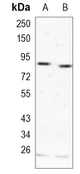 RSK2 Rabbit Monoclonal Antibody