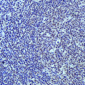 BRD4 Rabbit Monoclonal Antibody