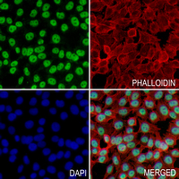 BRD4 Rabbit Monoclonal Antibody