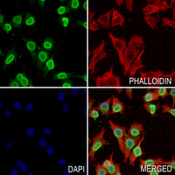 hnRNP U Rabbit Monoclonal Antibody