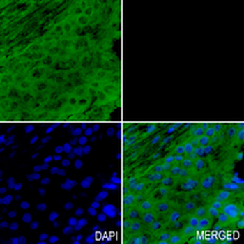 TOE1 Rabbit Monoclonal Antibody