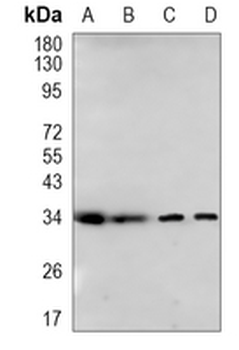 Cyclin D1 Rabbit Monoclonal Antibody