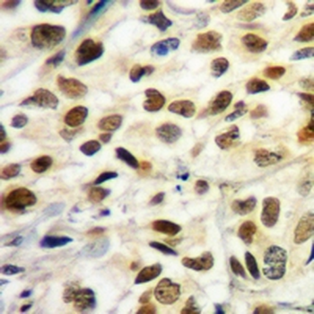 Cyclin D1 Rabbit Monoclonal Antibody