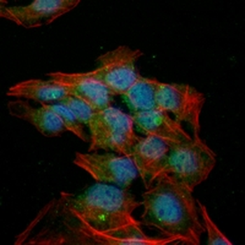 Cyclin D1 Rabbit Monoclonal Antibody