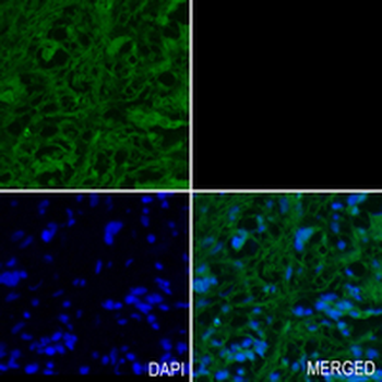 HSPA2 Rabbit Monoclonal Antibody