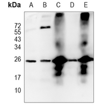 TPPP Rabbit Monoclonal Antibody