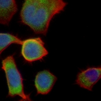 VAMP2 Rabbit Monoclonal Antibody