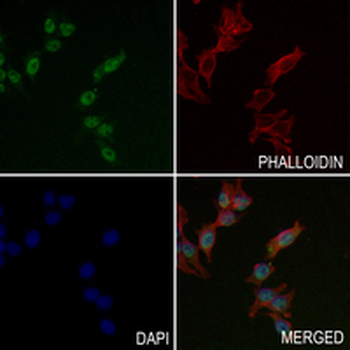 TARDBP Rabbit Monoclonal Antibody