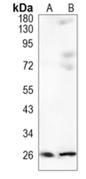 UCH-L3 Rabbit Monoclonal Antibody