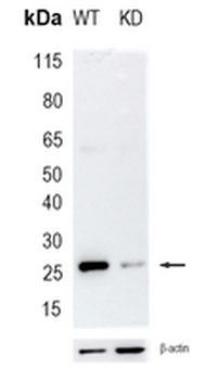 UCH-L3 Rabbit Monoclonal Antibody