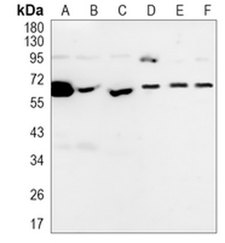 E2F1 Rabbit Monoclonal Antibody