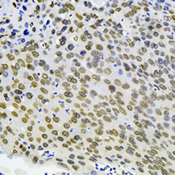 E2F1 Rabbit Monoclonal Antibody