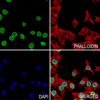 E2F1 Rabbit Monoclonal Antibody