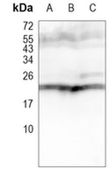 PSMB8 Rabbit Monoclonal Antibody