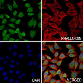 PSMB8 Rabbit Monoclonal Antibody