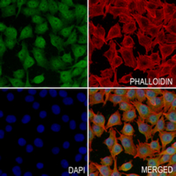 PAX6 Rabbit Monoclonal Antibody