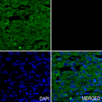 IKK alpha Rabbit Monoclonal Antibody