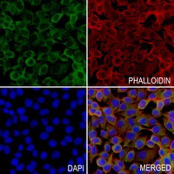 IKK alpha Rabbit Monoclonal Antibody