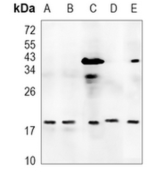 NDUFS4 Rabbit Monoclonal Antibody