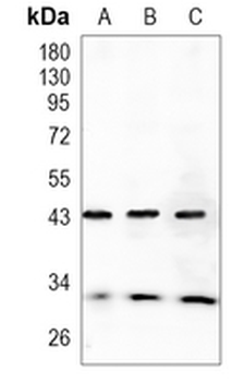 NDRG1 Rabbit Monoclonal Antibody