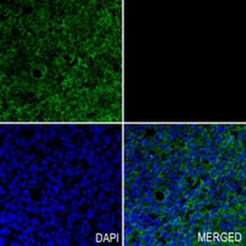 NDRG1 Rabbit Monoclonal Antibody